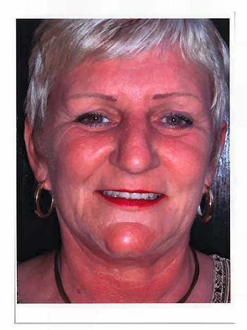 Allisan St.Claire After